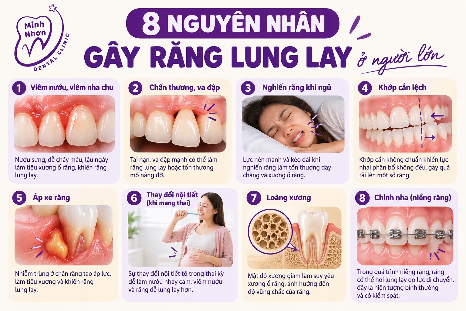 8 nguyên nhân gây răng lung lay ở người lớn